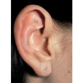 0,23*1,4 Agujas de presión