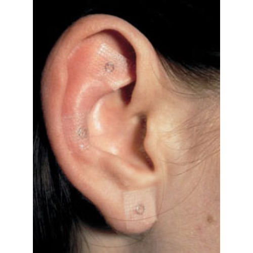 0,23*1,4 Agulles de pressió